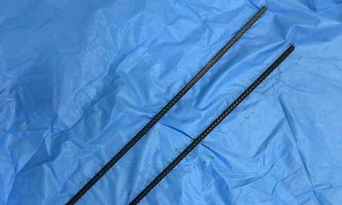 Man saved after two iron rods pierce his body