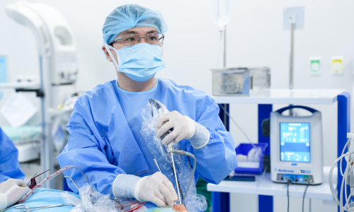 Can nasal polyps recur after surgery?