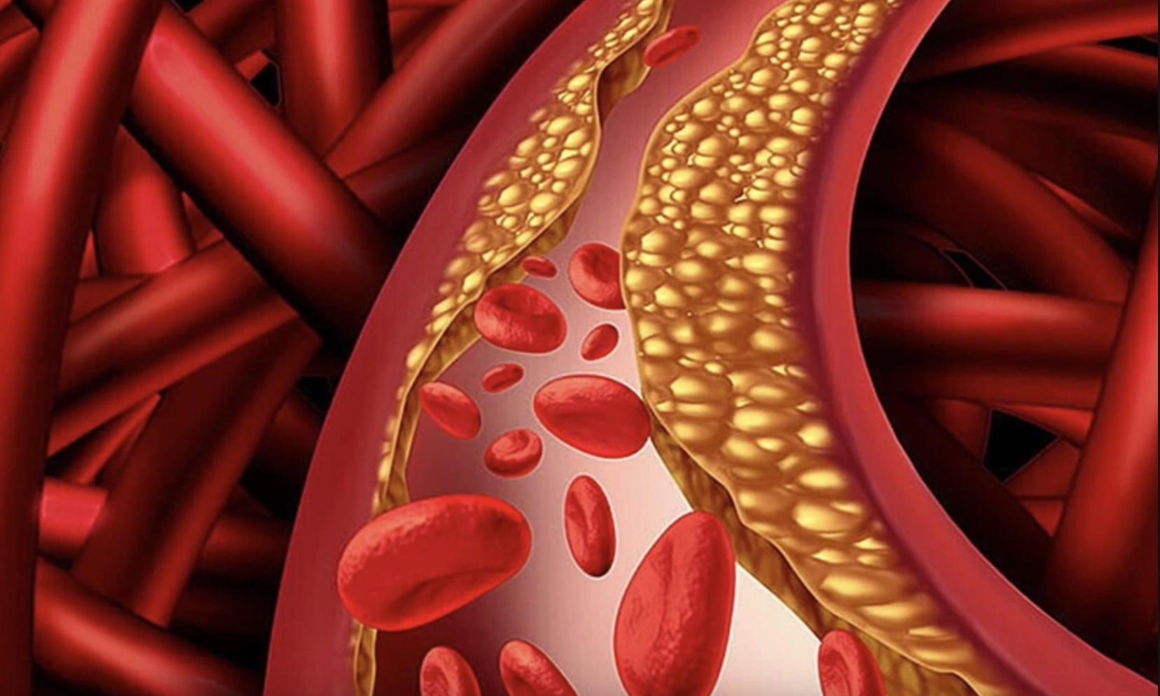 Japanese doctor warns of three blood types that can 'trigger' stroke