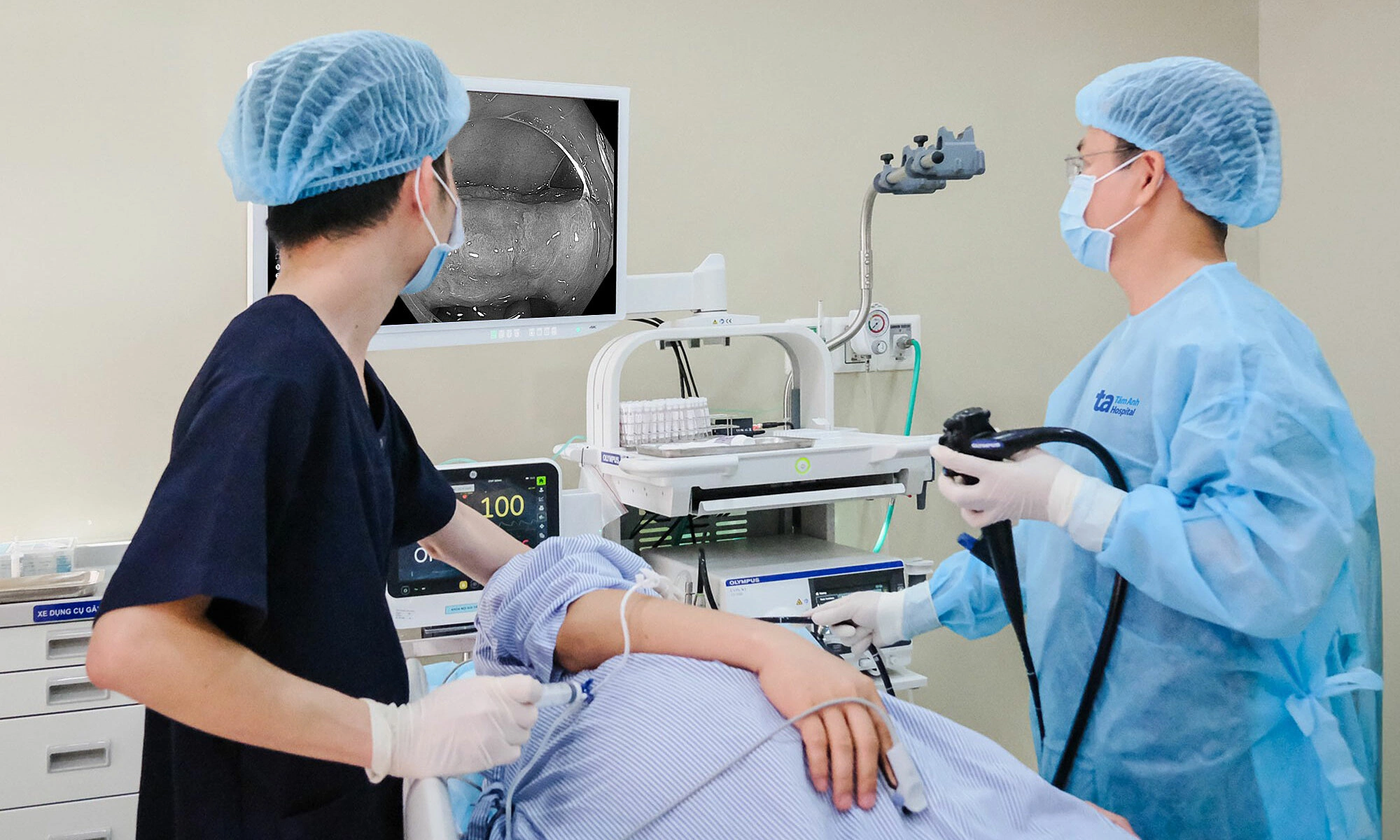 Large polyp nearly half a handspan causes severe hemorrhage
