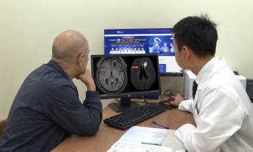 Ruptured brain abscess