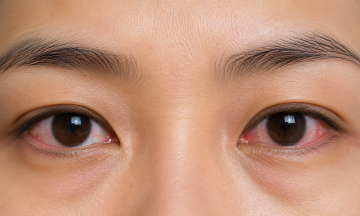 Why do pupils dilate?