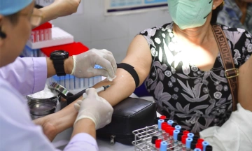 Excessive thirst, temporary blurred vision: early warning signs of type 2 diabetes