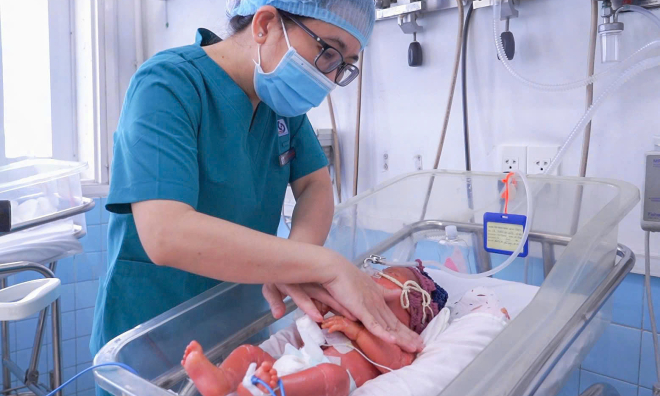 Baby boy born with 'fish scale' disease