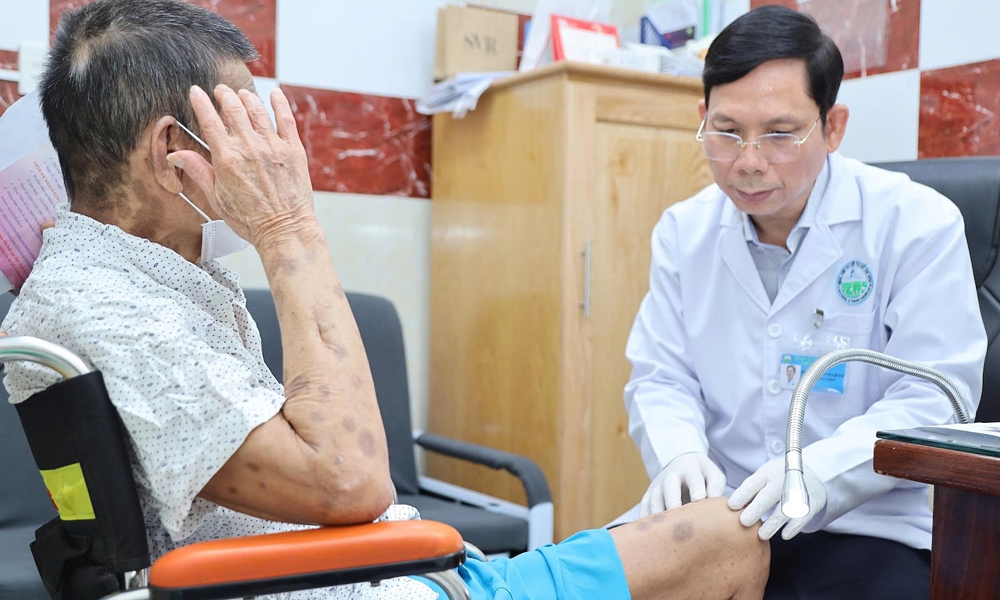 'Nightmare' of nerve pain after shingles heals