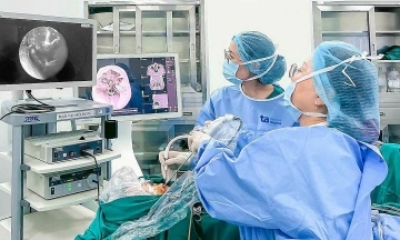 4th sinus surgery for a woman
